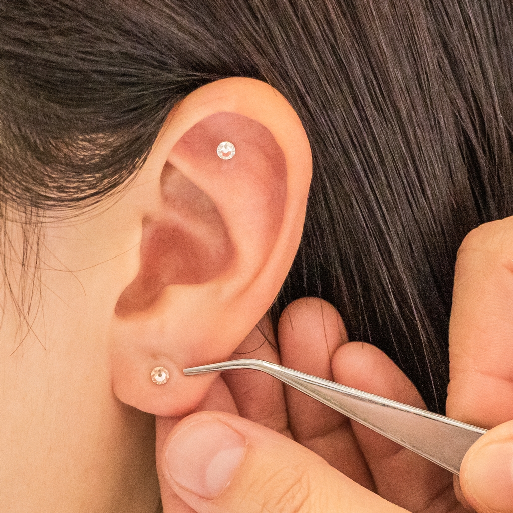 睡眠と自律神経の乱れを整える鍼灸施術の様子