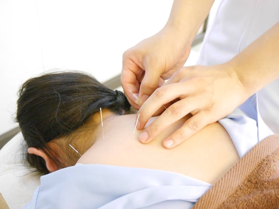 鍼灸で自律神経を整える施術｜寝ても疲れが取れない不調のケア